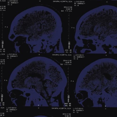 Mind over Matter