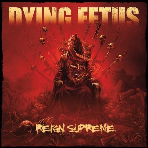Reign Supreme (Deluxe Version)